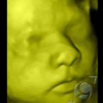Foto 3D 13