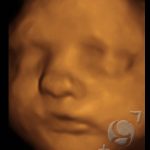 Foto 3D 15