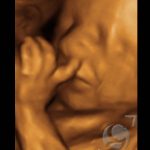 Foto 3D 20