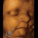 Foto 3D 25