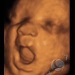 Foto 3D 26