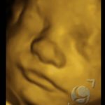Foto 3D 28