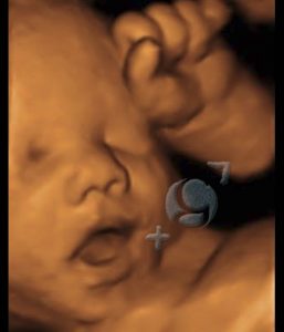 Foto 3D 32