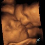 Foto 3D 41
