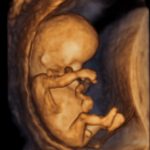 Sem 11 510x595
